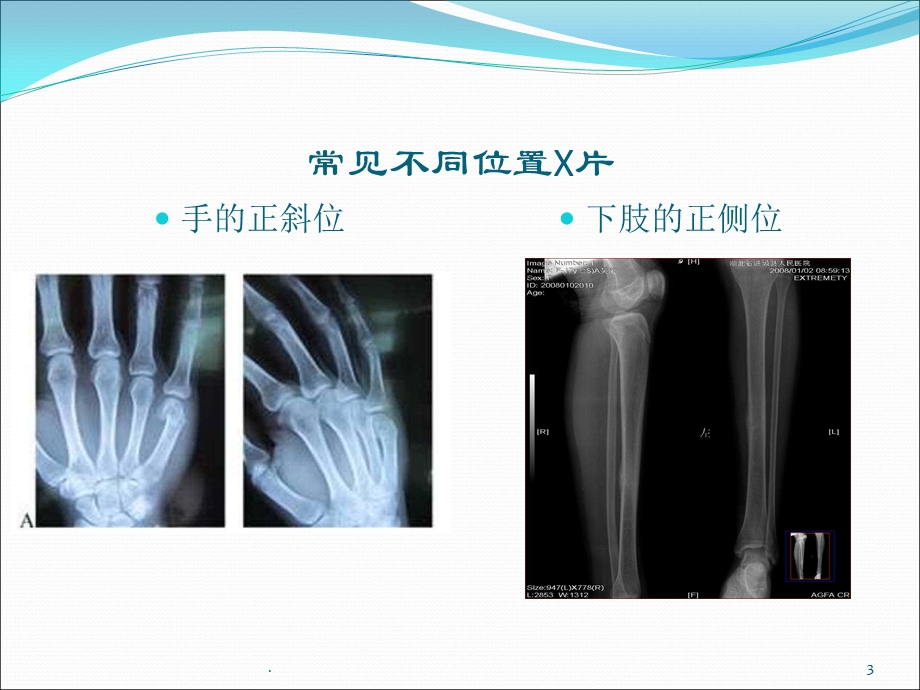 骨科常规诊断技术ppt课件.ppt_第3页