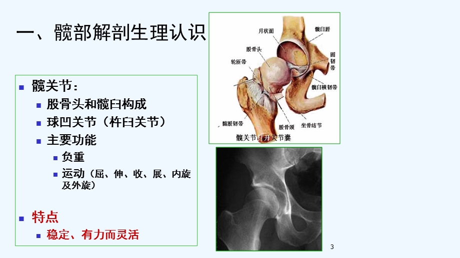 髋关节置换术后的健康宣教课件.ppt_第3页