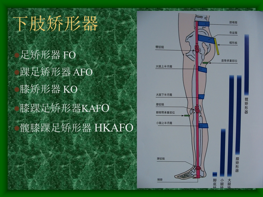 下肢矫形器的种类与应用教学文案课件.ppt_第2页