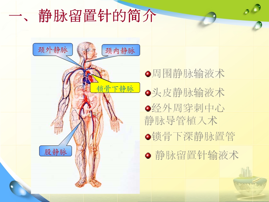 静脉留置针常见并发症预防及护理课件.pptx_第2页