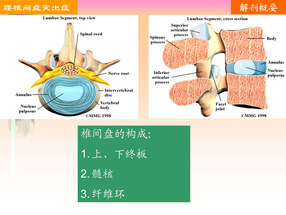 腰椎间盘突出的护理查房汇编课件.ppt_第3页