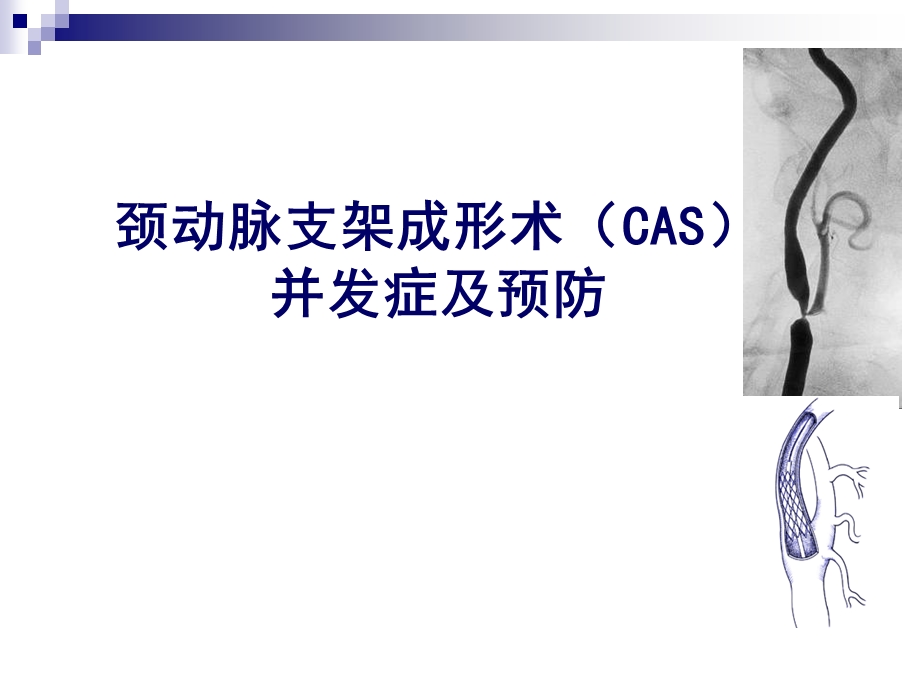 颈动脉CAS并发症与预防课件.ppt_第1页