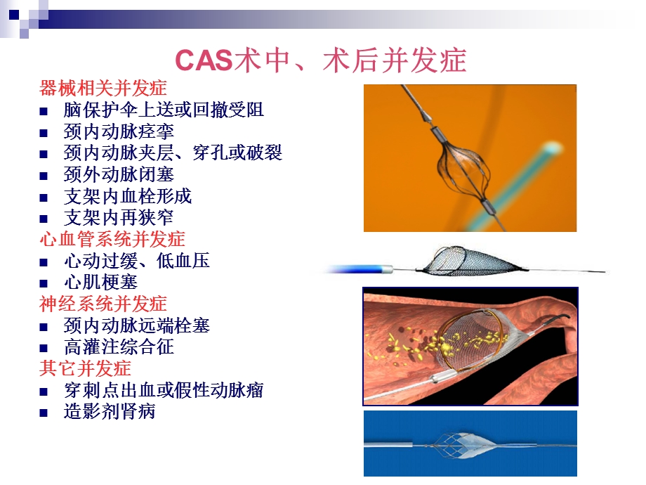 颈动脉CAS并发症与预防课件.ppt_第3页