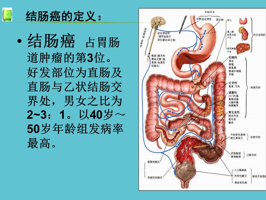 乙状结肠癌护理查房ppt资料课件.ppt_第3页