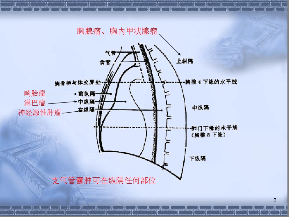 CT纵隔淋巴结分区演示ppt课件.ppt_第2页