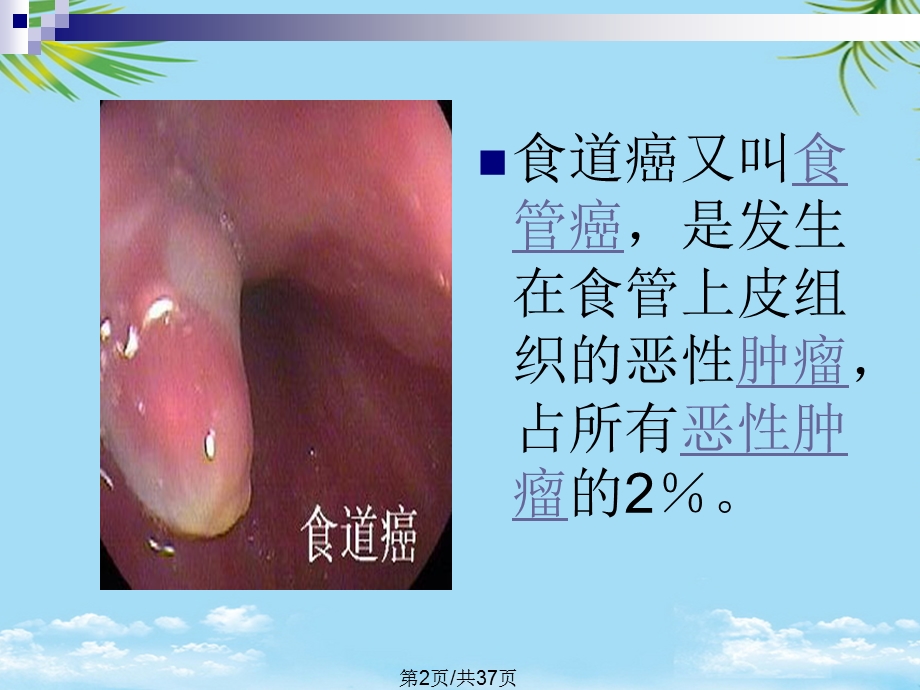 食管癌的治疗PPT全面版课件.pptx_第2页