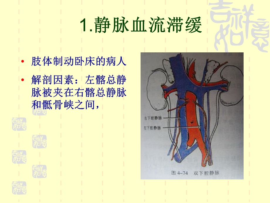 下肢深静脉血栓ppt课件1教学内容.ppt_第3页