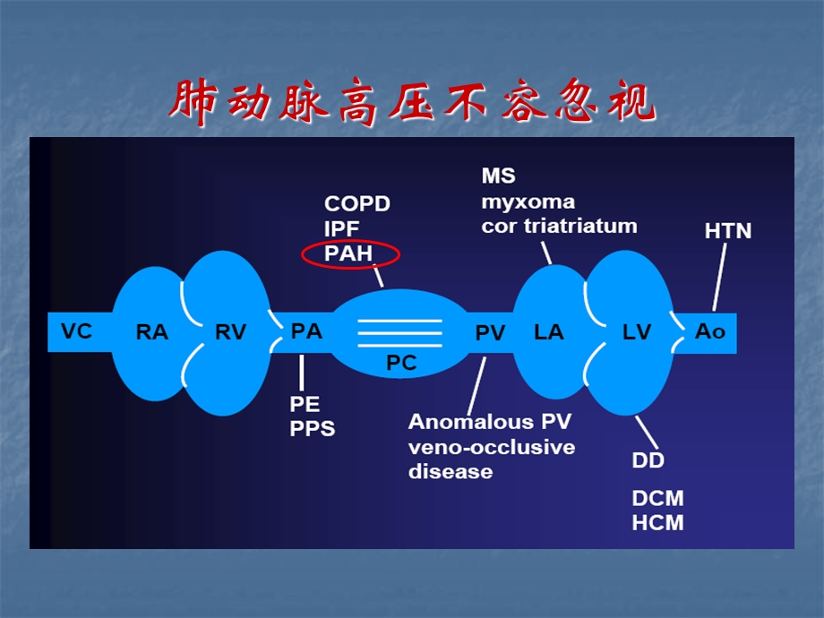 SLE-PAH诊治共识解读课件.ppt_第3页