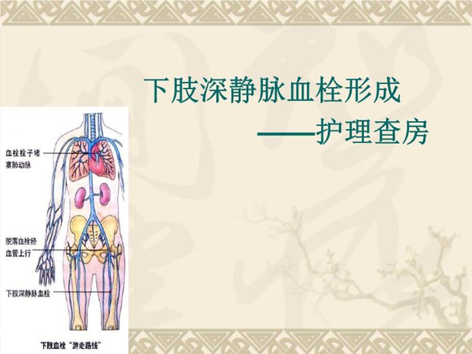 下肢深静脉血栓查房课件.ppt_第2页