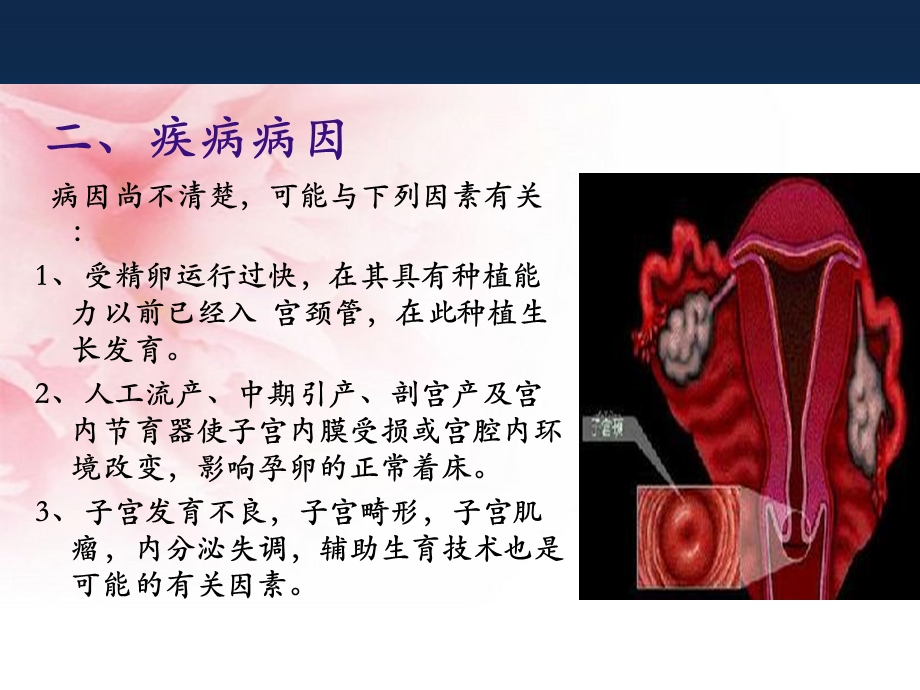 宫颈妊娠业务学习ppt课件.ppt_第3页