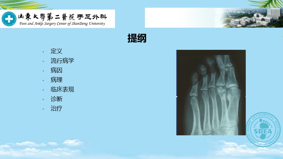 跖骨头缺血性坏死ppt资料课件.ppt_第2页