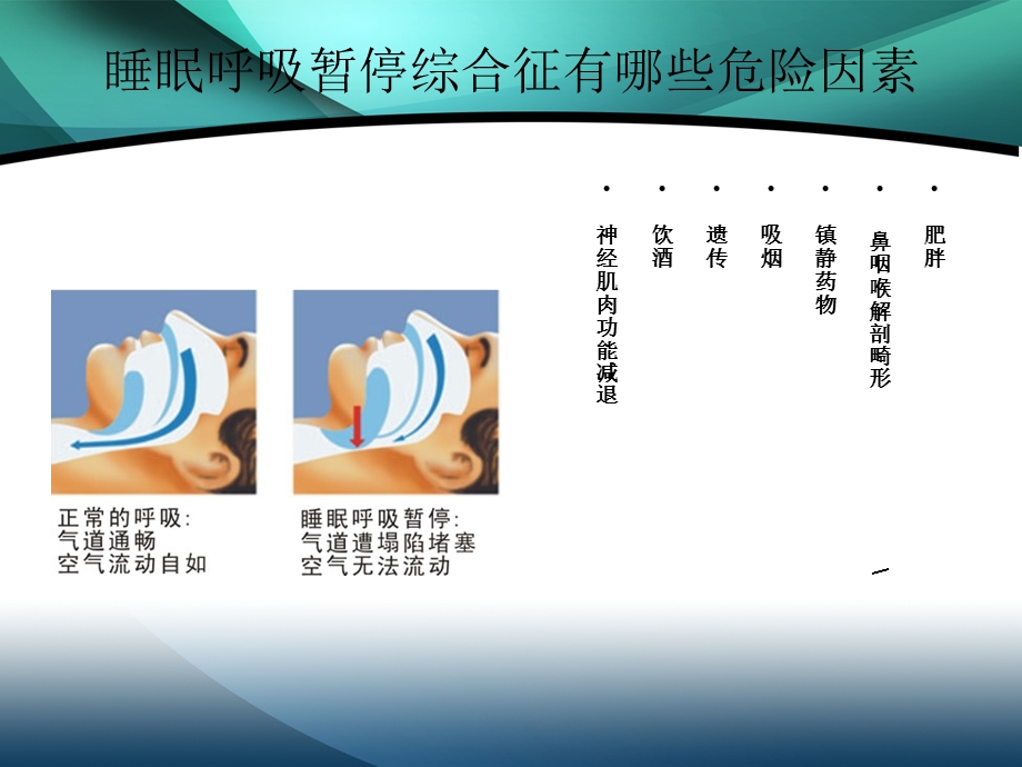 阻塞性睡眠呼吸暂停综合征的健康教育汇编课件.ppt_第3页