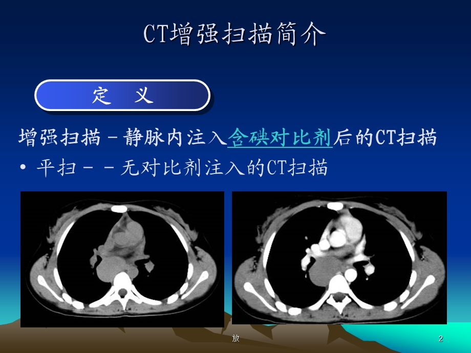 CT增强扫描的临床应用幻灯片ppt课件.ppt_第2页