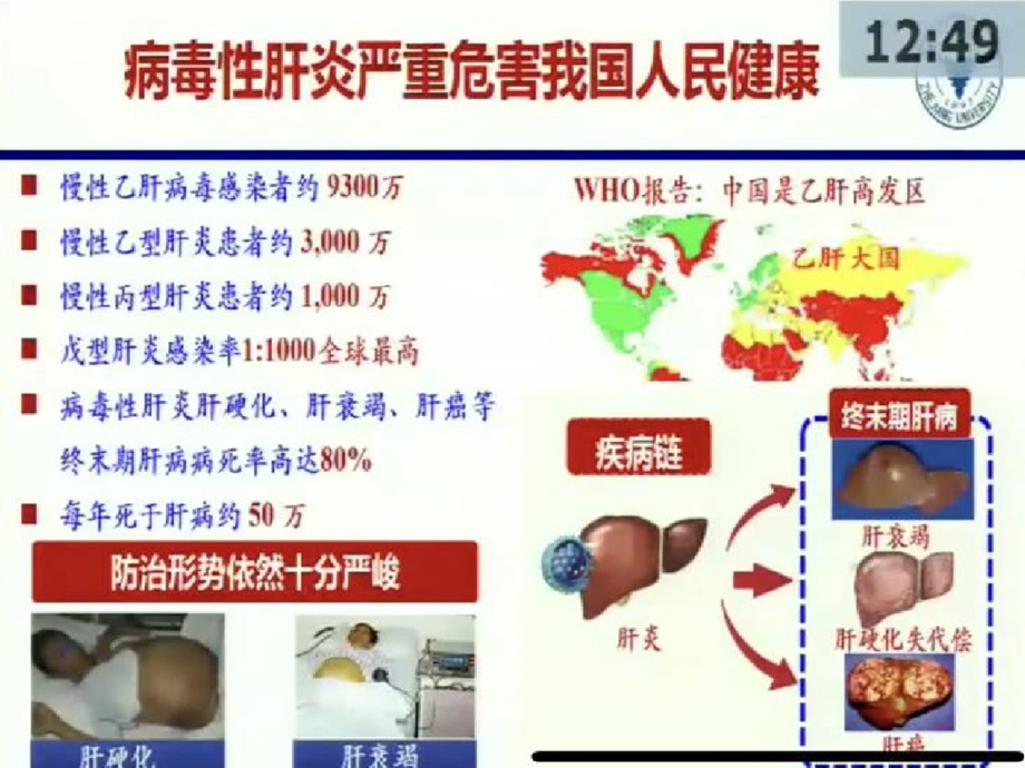 C感染性疾病病毒性肝炎国家临床医学的研究中心建设的思考课件.ppt_第3页