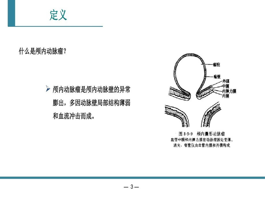 颅内动脉瘤CTA诊断课件.ppt_第3页