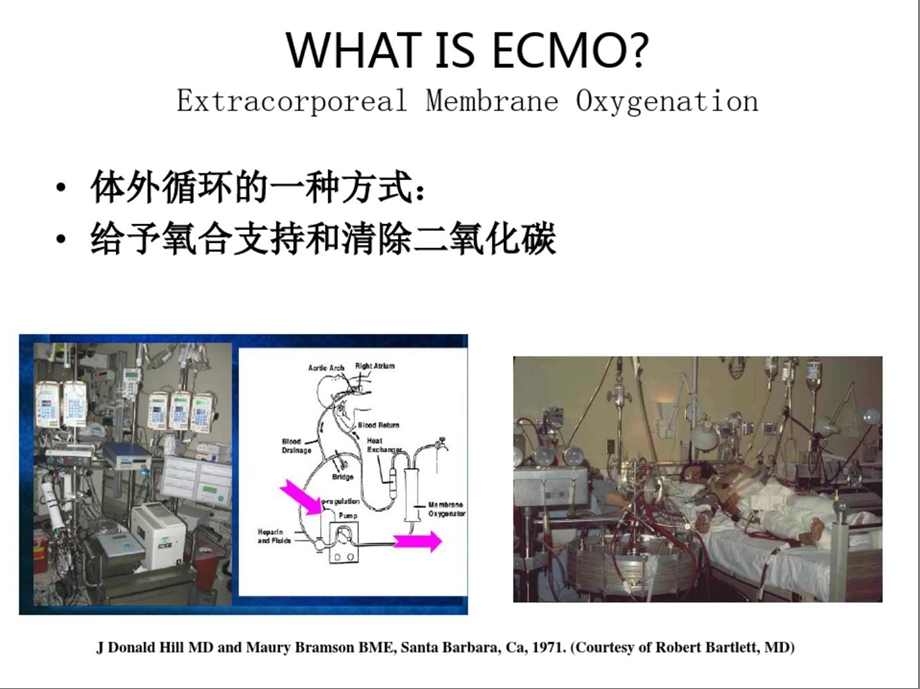 VV-ECMO的氧输送和血流动力学课件.ppt_第3页