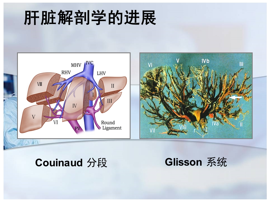 左半肝切除课件.ppt_第2页