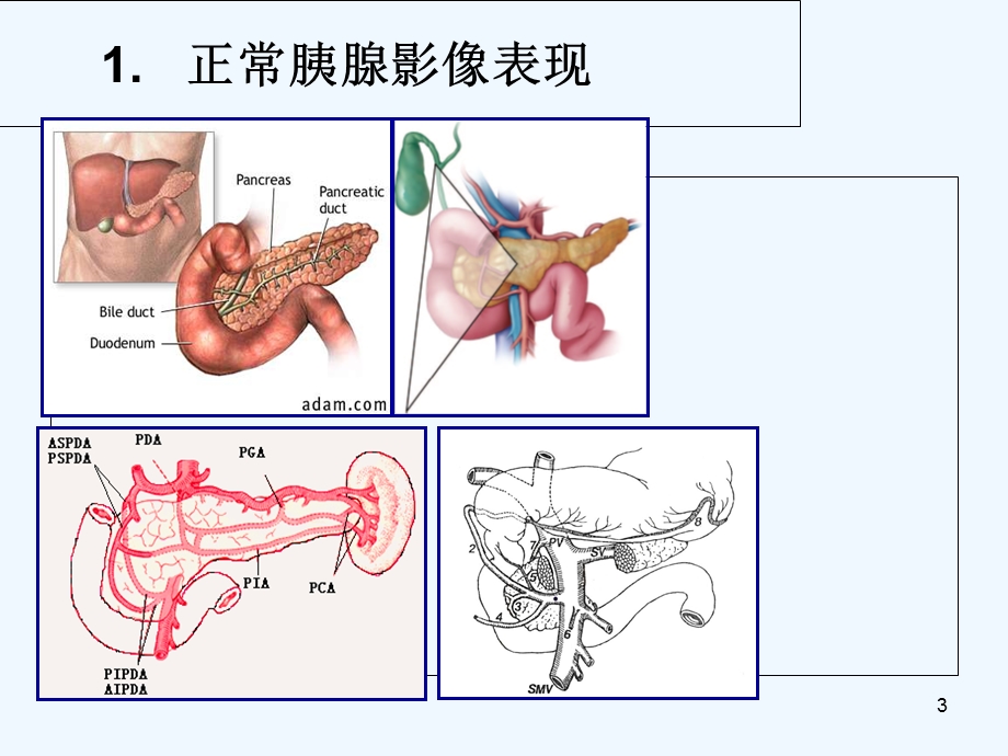 重症胰腺炎CT影像学诊断急症课件.ppt_第3页