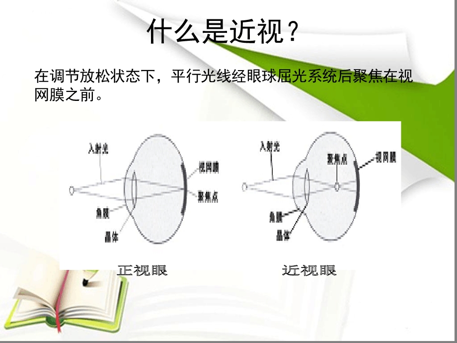 角膜塑形镜讲课课件.ppt_第3页