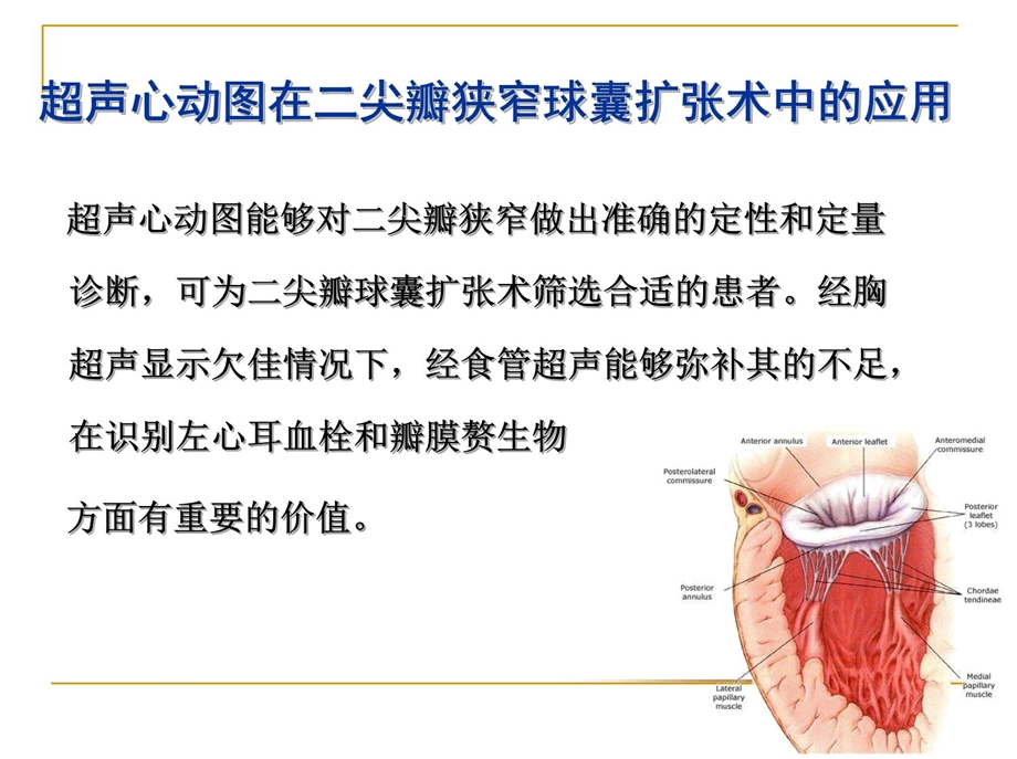 超声心动图在心脏瓣膜病介入治疗中的应用课件.ppt_第3页