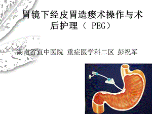 经皮胃镜下胃造瘘术操作与术后护理课件.ppt