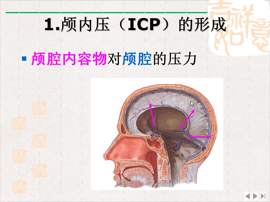 颅脑疾病病人的护理ppt新版课件.pptx_第2页