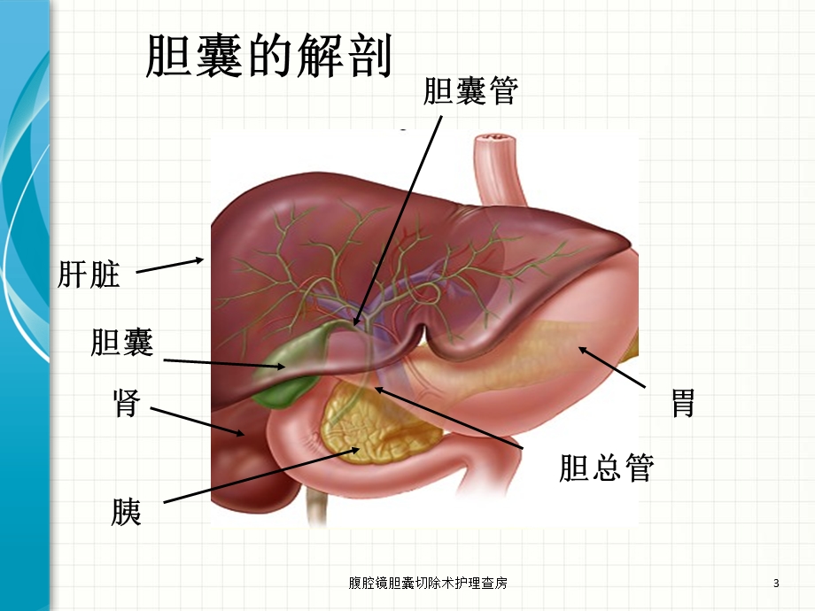 腹腔镜胆囊切除术护理查房ppt课件.ppt_第3页