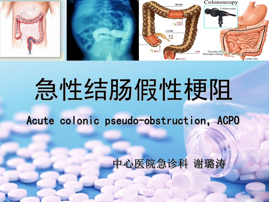 急性结肠假性梗阻 课件.ppt_第1页