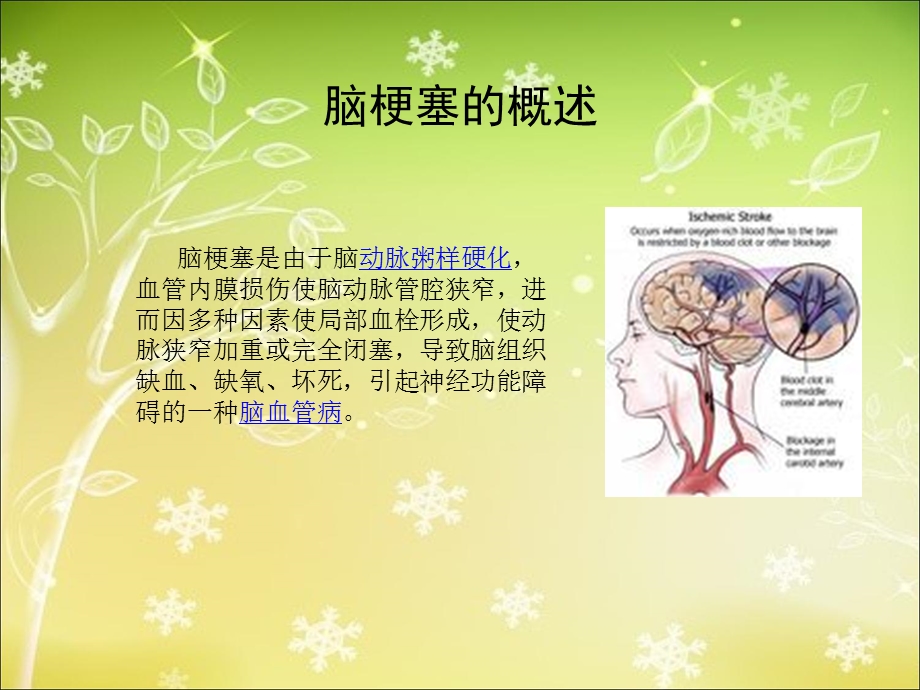 脑梗塞病人护理查房ppt课件.ppt_第2页