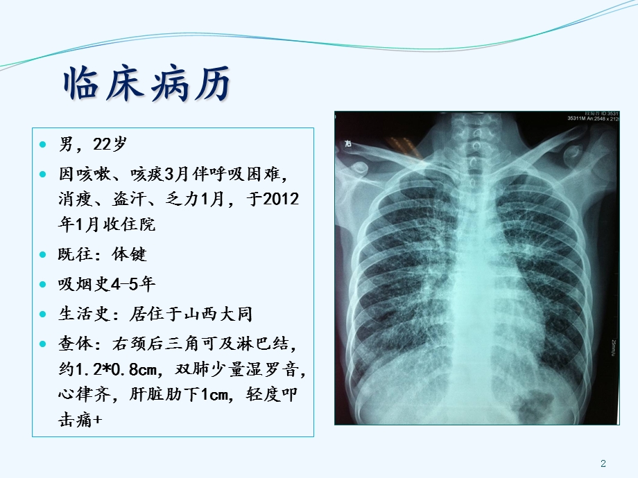 肺癌的预防和早期发现课件.ppt_第2页
