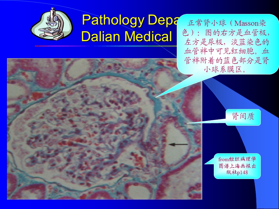 病理学ppt课件 第十章泌尿系统疾病.ppt_第3页