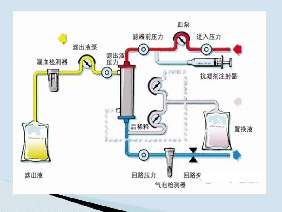 血液透析护理操作过程风险管理课件.pptx_第2页