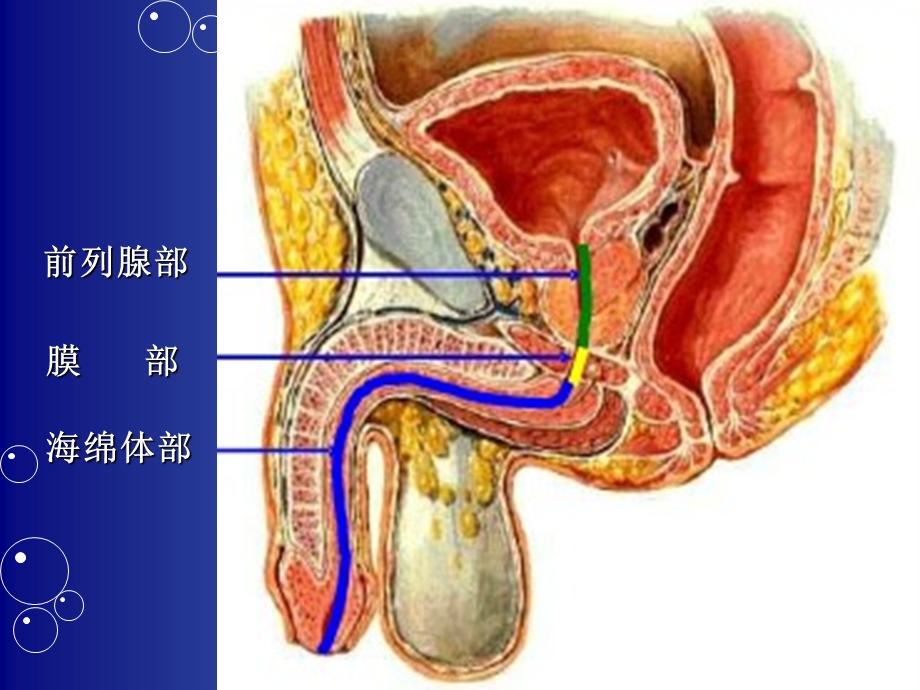 预防留置尿管感染的护理措施课件.ppt_第3页