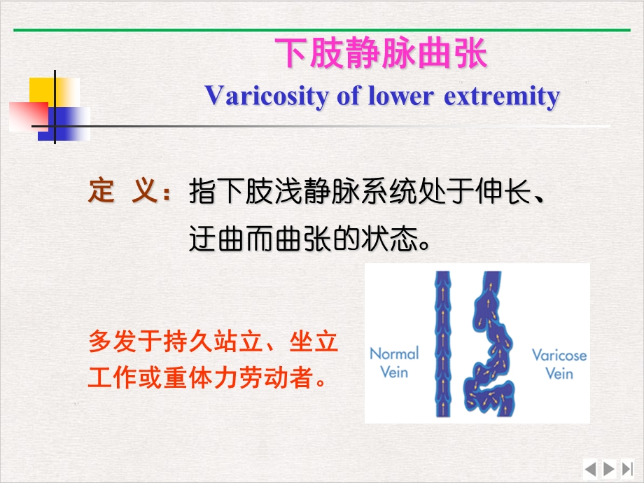 静脉曲张的相关知识和预防措施课件.pptx_第2页