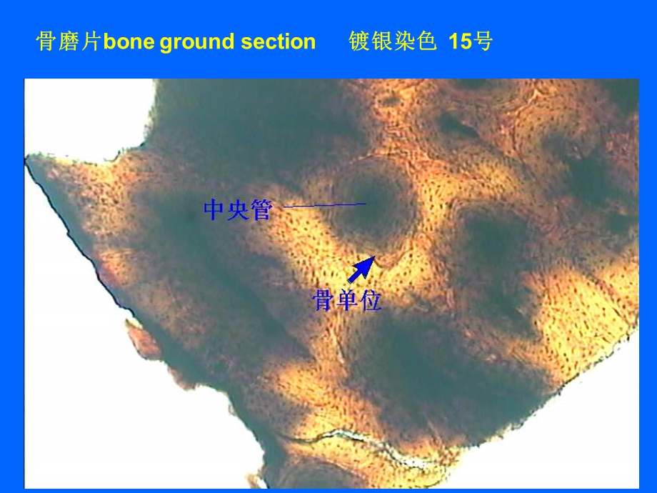 《组织学与胚胎学》教学-实验三、骨与血液课件.ppt_第3页