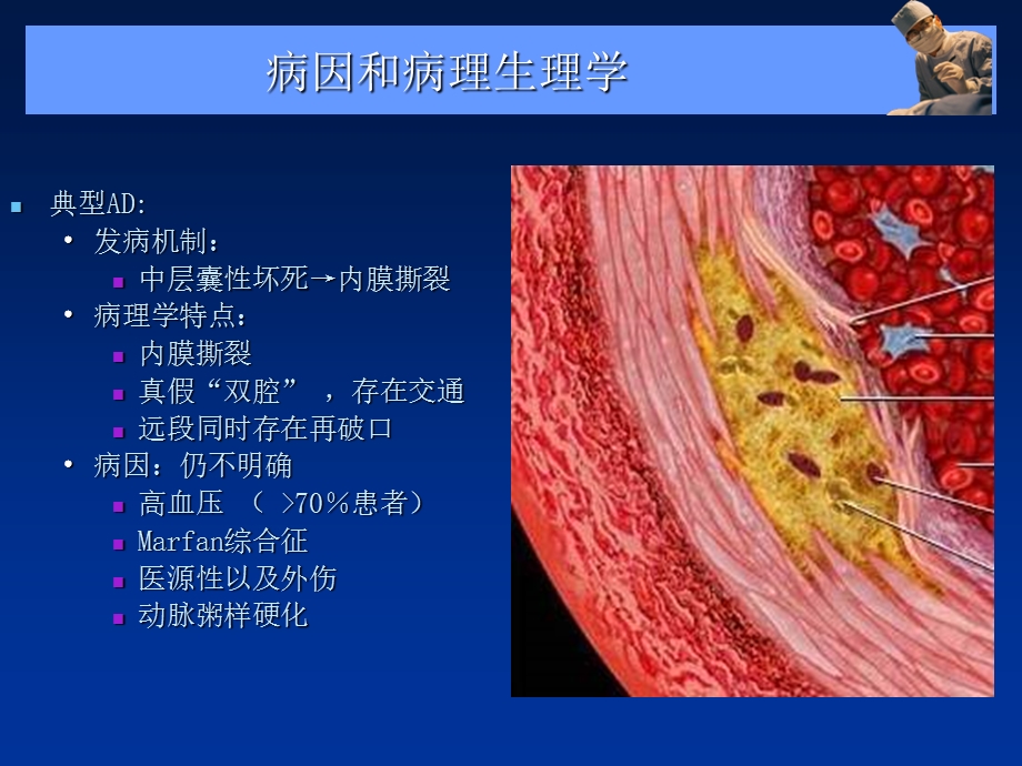 急性主动脉综合征课件.ppt_第3页