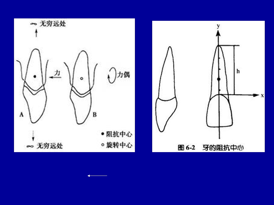 正畸治疗的生物机械原理口腔医学ppt课件.ppt_第3页