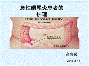 急性阑尾炎患者的护理 ppt课件.ppt