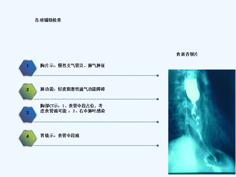 食道癌个案护理课件.ppt_第3页