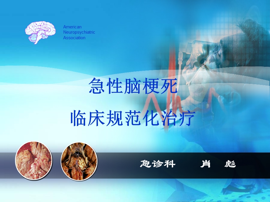 急性脑梗规范治疗死课件.ppt_第1页