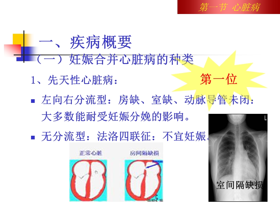 第八章妊娠合并症病人的护理课件.ppt_第3页