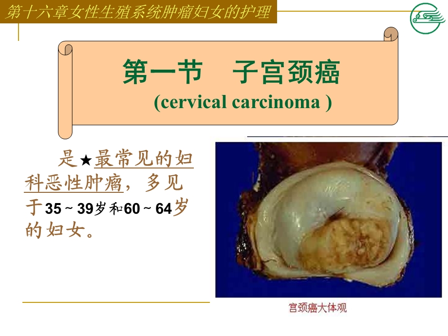 第十六章女性生殖系统肿瘤一二节课件.ppt_第3页