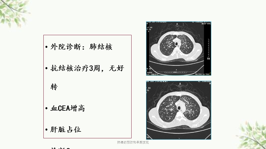 肺癌的预防和早期发现ppt课件.ppt_第3页