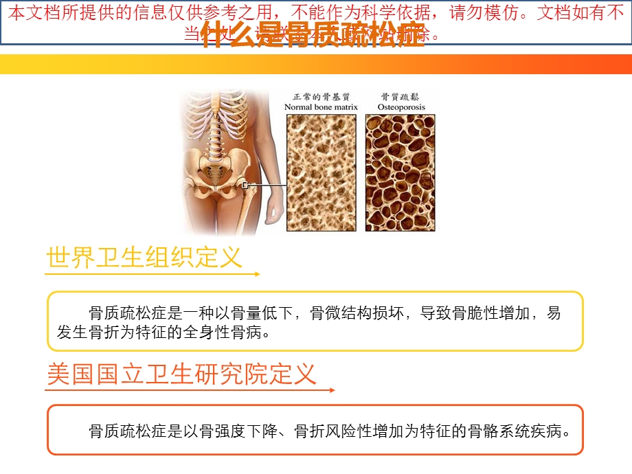 骨质疏松健康讲座培训ppt课件.ppt_第2页