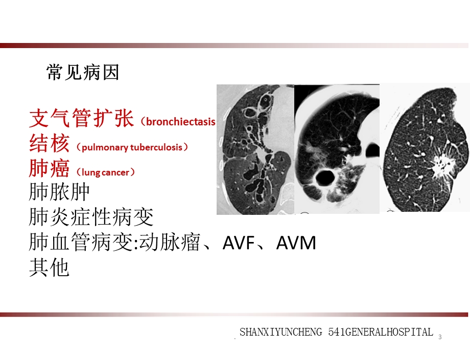 大咯血的介入治疗演示ppt课件.pptx_第3页