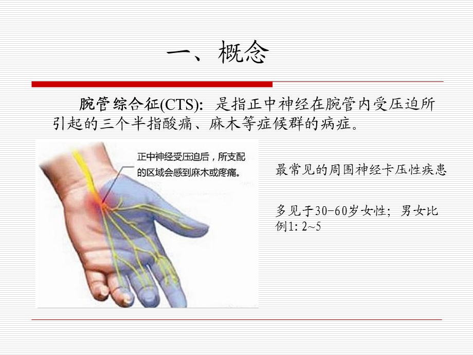 腕管综合征的诊断课件.ppt_第1页