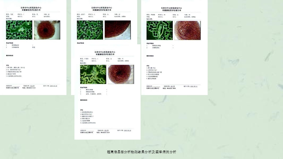 超高倍显微分析检测结果分析及图库病例分析ppt课件.ppt_第3页