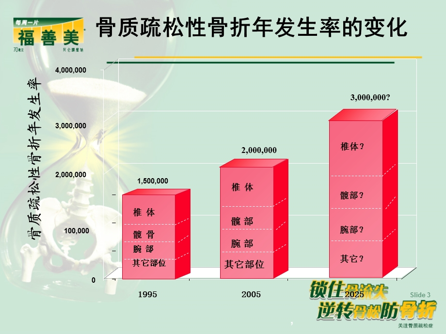 骨质疏松症筛查与诊断课件.ppt_第3页