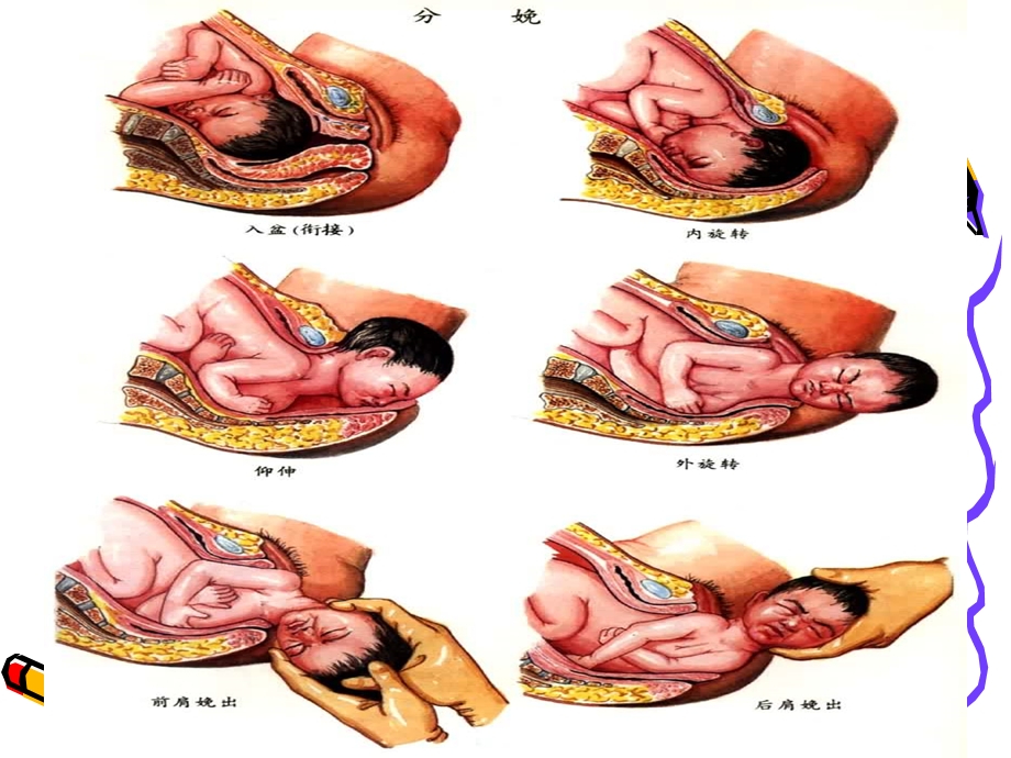 正常分娩妇女的护理课件.ppt_第3页