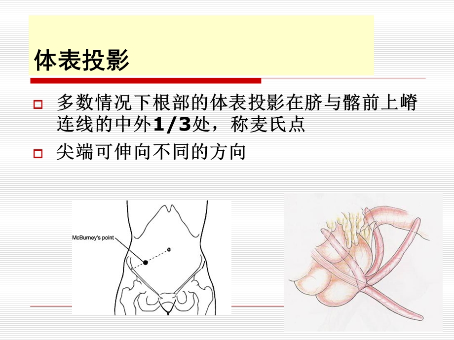 急性阑尾炎的诊治课件.ppt_第3页